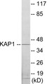 Western blot analysis of extracts from COLO205 cells, using KAP1 Antibody. The lane on the right is treated with the synthesized peptide.