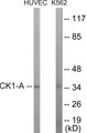 Western blot analysis of extracts from HuvEc/K562 cells, using CKI-alpha Antibody.