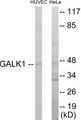 Western blot analysis of extracts from HuvEc/HeLa cells, using GALK1 Antibody. The lane on the right is treated with the synthesized peptide.