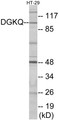 Western blot analysis of extracts from HT-29 cells, using DGKQ Antibody. The lane on the right is treated with the synthesized peptide.