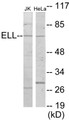 Western blot analysis of extracts from Jurkat/HeLa cells, using ELL Antibody. The lane on the right is treated with the synthesized peptide.