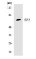 Western blot analysis of extracts from Jurkat cells, using SP2 Antibody. The lane on the right is treated with the synthesized peptide.