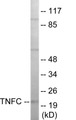 Western blot analysis of extracts from HepG2 cells, using TNFC Antibody.