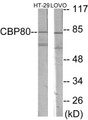 Western blot analysis of extracts from HT-29/LOVO cells, using NCBP1 Antibody. The lane on the right is treated with the synthesized peptide.