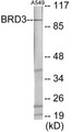 Western blot analysis of extracts from A549 cells, using BRD3 Antibody. The lane on the right is treated with the synthesized peptide.