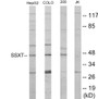Western blot analysis of extracts from HepG2/Jurkat/COLO205 cells, using SSXT Antibody. The lane on the right is treated with the synthesized peptide.