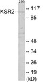 Western blot analysis of extracts from 293 cells, using KSR2 Antibody.
