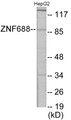 Western blot analysis of extracts from HepG2 cells, using ZNF785 Antibody. The lane on the right is treated with the synthesized peptide.
