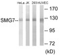 Western blot analysis of extracts from HeLa/Jurkat/293/HuvEc cells, using SMG7 Antibody.