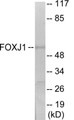 Western blot analysis of extracts from LOVO cells, using FOXJ1 Antibody. The lane on the right is treated with the synthesized peptide.