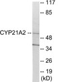 Western blot analysis of extracts from 293 cells, using Cytochrome P450 21A2 Antibody. The lane on the right is treated with the synthesized peptide.
