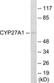 Western blot analysis of extracts from HeLa cells, using Cytochrome P450 27A1 Antibody. The lane on the right is treated with the synthesized peptide.
