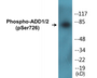 Western blot analysis of extracts from HeLa cells treated with Forskolin 40nM 30', using ADD1 (Phospho-Ser726) Antibody.