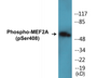 Western blot analysis of extracts from HeLa cells treated with PMA 125ng/ml 30', using MEF2A (Phospho-Ser408) Antibody.