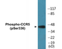 Western blot analysis of extracts from Jurkat cells, using CCR5 (Phospho-Ser336) Antibody.