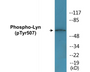 Western blot analysis of extracts from K562 cells treated with H2O2 100uM 30', using Lyn (Phospho-Tyr507) Antibody.