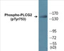 Western blot analysis of extracts from HepG2 cells treated with Na3VO4 0.3mM 40', using PLCG2 (Phospho-Tyr753) Antibody.