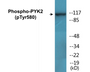 Western blot analysis of extracts from K562 cells, using PYK2 (Phospho-Tyr580) Antibody.