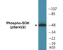 Western blot analysis of extracts from HeLa cells treated with Insulin 0.01U/ml 15', using SGK (Phospho-Ser422) Antibody.