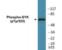 Western blot analysis of extracts from A549 cells, using SYK (Phospho-Tyr525) Antibody.