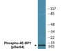 Western blot analysis of extracts from Jurkat cells treated with Insulin 0.01U/ml 15', using 4E-BP1 (Phospho-Ser64) Antibody.