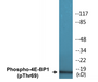 Western blot analysis of extracts from Jurkat cells treated with EGF 200ng/ml 30', using 4E-BP1 (Phospho-Thr69) Antibody.