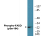 Western blot analysis of extracts from HeLa cells treated with Paclitaxel 1uM 60', using FADD (Phospho-Ser194) Antibody.