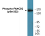 Western blot analysis of extracts from HT29 cells treated with Calyculin A 50ng/ml 30', using FANCD2 (Phospho-Ser222) Antibody.