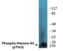 Western blot analysis of extracts from HuvEc cells treated with Serum 20% 30', using Histone H3 (Phospho-Thr3) Antibody.