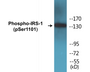 Western blot analysis of extracts from COS7 cells treated with Calyculin A 50ng/ml 30', using IRS-1 (Phospho-Ser1101) Antibody.