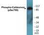 Western blot analysis of extracts from HeLa cells treated with EGF 200ng/ml 30', using Caldesmon (Phospho-Ser789) Antibody.