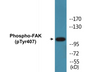 Western blot analysis of extracts from COS7 cells treated with EGF 200ng/ml 30', using FAK (Phospho-Tyr407) Antibody.