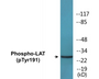 Western blot analysis of extracts from NIH-3T3 cells, using LAT (Phospho-Tyr191) Antibody.