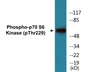 Western blot analysis of extracts from A549 cells, using n-NOS (Phospho-Ser852) Antibody.