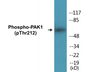Western blot analysis of extracts from 293 cells treated with etoposide 25uM 1h, using PAK1 (Phospho-Thr212) Antibody.