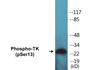 Western blot analysis of extracts from HeLa cells treated with paclitaxel 1uM 24h, using TK (Phospho-Ser13) Antibody.