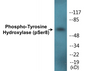 Western blot analysis of extracts from HepG2 cells treated with Anisomycin 25ug/ml 30', using Tyrosine Hydroxylase (Phospho-Ser8) Antibody.