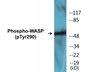 Western blot analysis of extracts from HepG2 cells, using WASP (Phospho-Tyr290) Antibody.