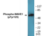 Western blot analysis of extracts from NIH-3T3 cells treated with Insulin 0.01U/ml 15', using WAVE1 (Phospho-Tyr125) Antibody.