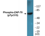 Western blot analysis of extracts from Jurkat cells treated with Ca+ 40nM 30', using ZAP-70 (Phospho-Tyr315) Antibody.