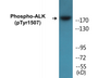 Western blot analysis of extracts from COS7 cells treated with anisomycin 25ug/ml 30', using ALK (Phospho-Tyr1507) Antibody.