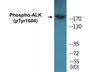 Western blot analysis of extracts from HepG2 cells, using ALK (Phospho-Tyr1604) Antibody.