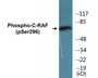 Western blot analysis of extracts from 293 cells treated with PMA 125ng/ml 30' , using C-RAF (Phospho-Ser296) Antibody.
 
