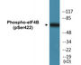 Western blot analysis of extracts from NIH-3T3 cells, using eIF4B (Phospho-Ser422) Antibody.
 
