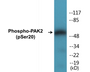 Western blot analysis of extracts from 293 cells treated with Sorbitol 0.4M 30', using PAK2 (Phospho-Ser20) Antibody.
 
