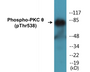Western blot analysis of extracts from Jurkat cells, using PKC thet (Phospho-Thr538) Antibody.
 
