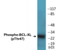 Western blot analysis of extracts from 293 cells treated with UV 30', using BCL-XL (Phospho-Thr47) Antibody. 