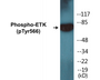 Western blot analysis of extracts from HeLa cells treated with Serum 20% 15', using ETK (Phospho-Tyr566) Antibody.