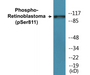 Western blot analysis of extracts from K562 cells, using Retinoblastoma (Phospho-Ser811) Antibody. 