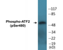 Western blot analysis of extracts from HuvEc cells treated with Anisomycin 25ug/ml 30', using ATF2 (Phospho-Ser480) Antibody.